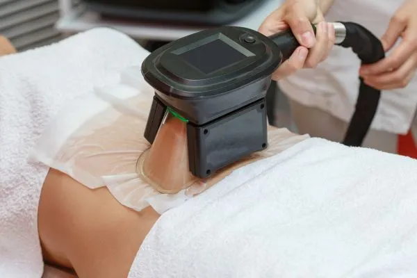 Image of person having fat freezing treatment to help weight gain Southall