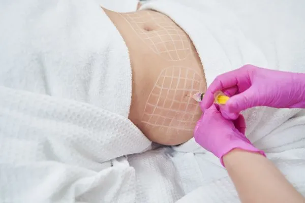 image of fat dissolving injections on love handles to help combat weight gain Southall