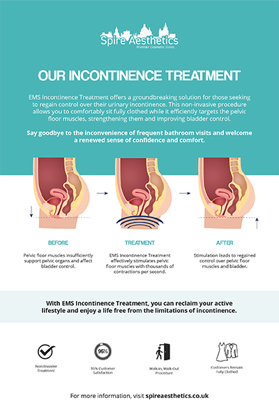 image of how urge incontinence Southall treatment works