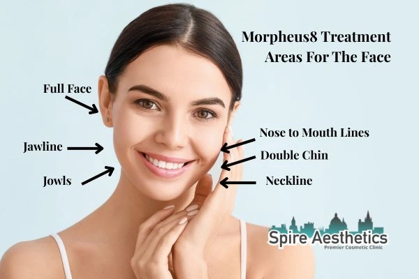 Where can Morpheus8 Treatment Southall be done on the body?