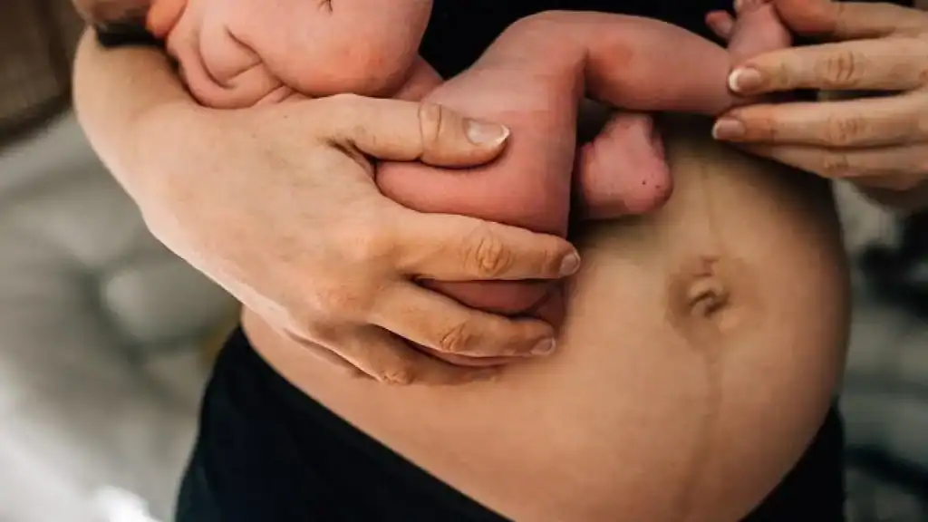 Why Is My Stomach Still Big After Pregnancy Southall?